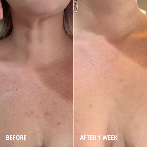 Daily Mineral Cleanser & Face Mask | 100% Natural